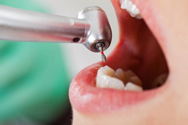 Best Emergency Dental Surgery in Providence Village, TX